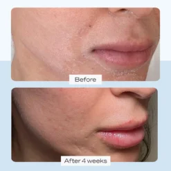 First Aid Beauty Ultra Repair Cream -Clinique || Lancome || L'Oreal Sales Shop 2295764cm alt03