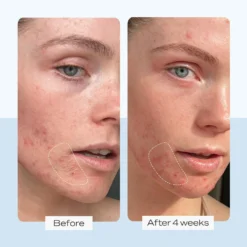 First Aid Beauty Ultra Repair Cream -Clinique || Lancome || L'Oreal Sales Shop 2295764cm alt04