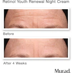 Murad Retinol Youth Renewal Night Cream -Clinique || Lancome || L'Oreal Sales Shop 2556346cm alt04