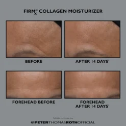 Peter Thomas Roth FIRMx Collagen Moisturizer 12 Peter Thomas Roth FIRMx Collagen Moisturizer -Clinique || Lancome || L'Oreal Sales Shop 2561084cm alt03