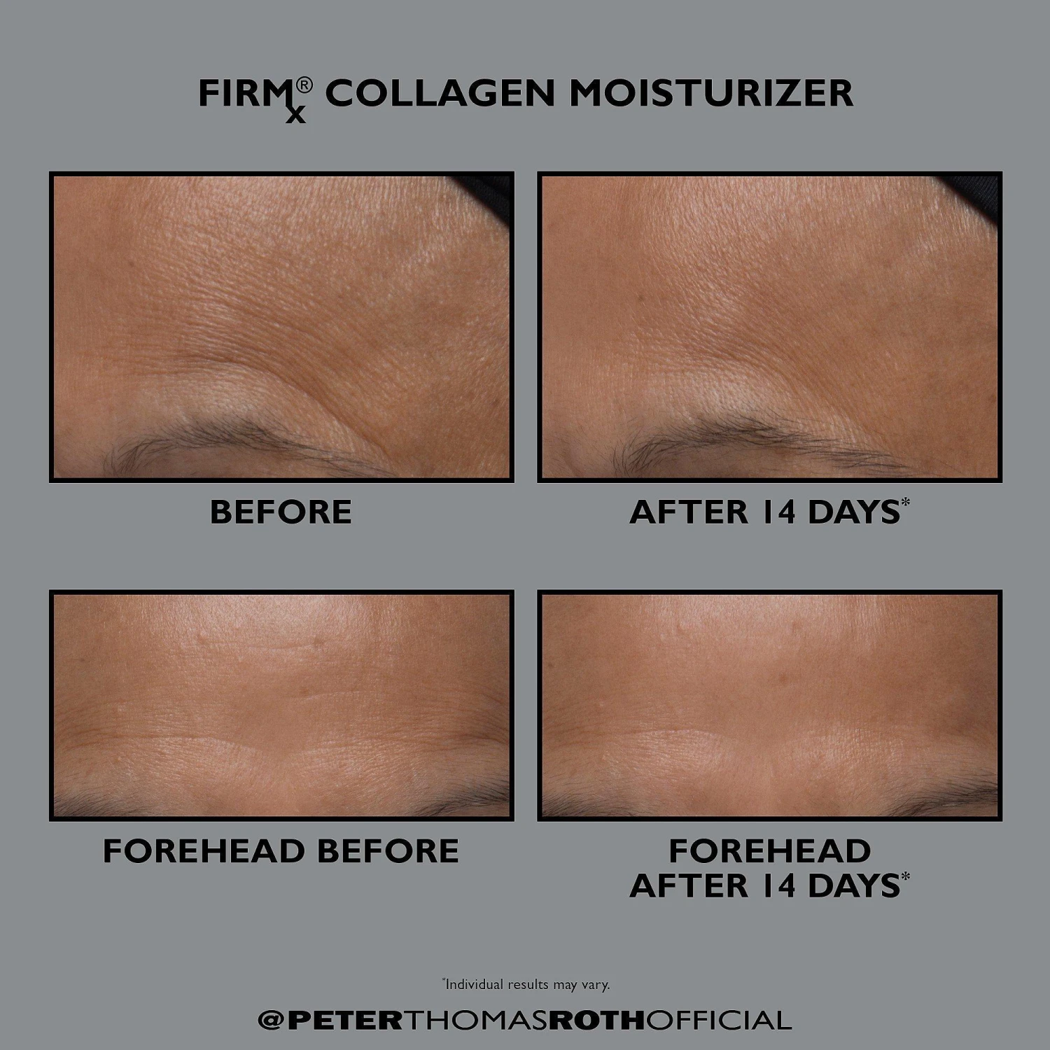 Peter Thomas Roth FIRMx Collagen Moisturizer 4 Peter Thomas Roth FIRMx Collagen Moisturizer - Image 4
