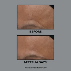 Peter Thomas Roth FIRMx Collagen Moisturizer 13 Peter Thomas Roth FIRMx Collagen Moisturizer -Clinique || Lancome || L'Oreal Sales Shop 2561084cm alt04