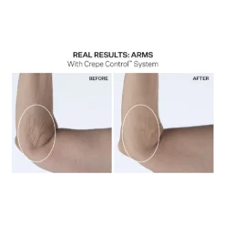 Crepe Control Tightening Body Cream 11 Crepe Control Tightening Body Cream -Clinique || Lancome || L'Oreal Sales Shop 2561150cm alt02