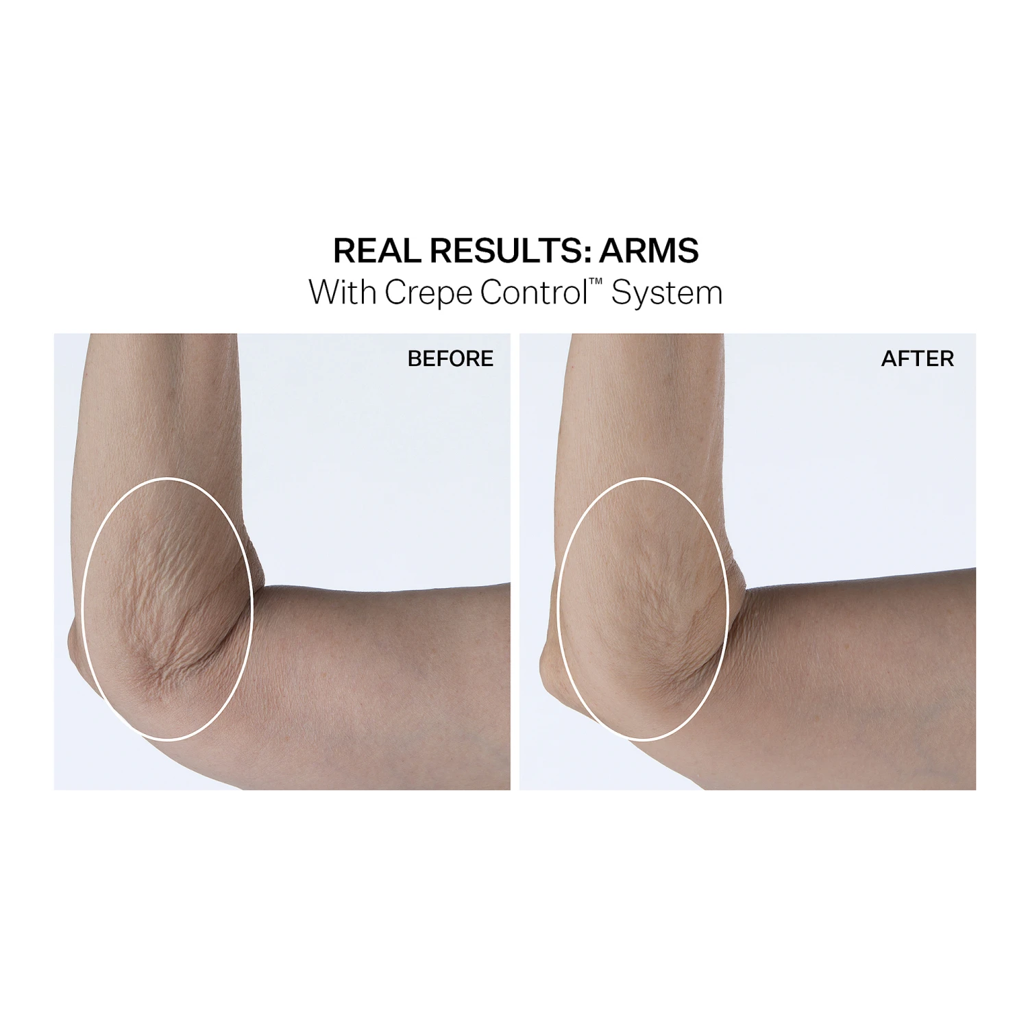 Crepe Control Tightening Body Cream 6 Crepe Control Tightening Body Cream - Image 6