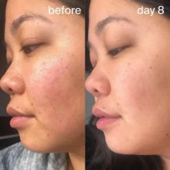 Resurfacing Sleep Mask -Clinique || Lancome || L'Oreal Sales Shop 2566453cm alt03