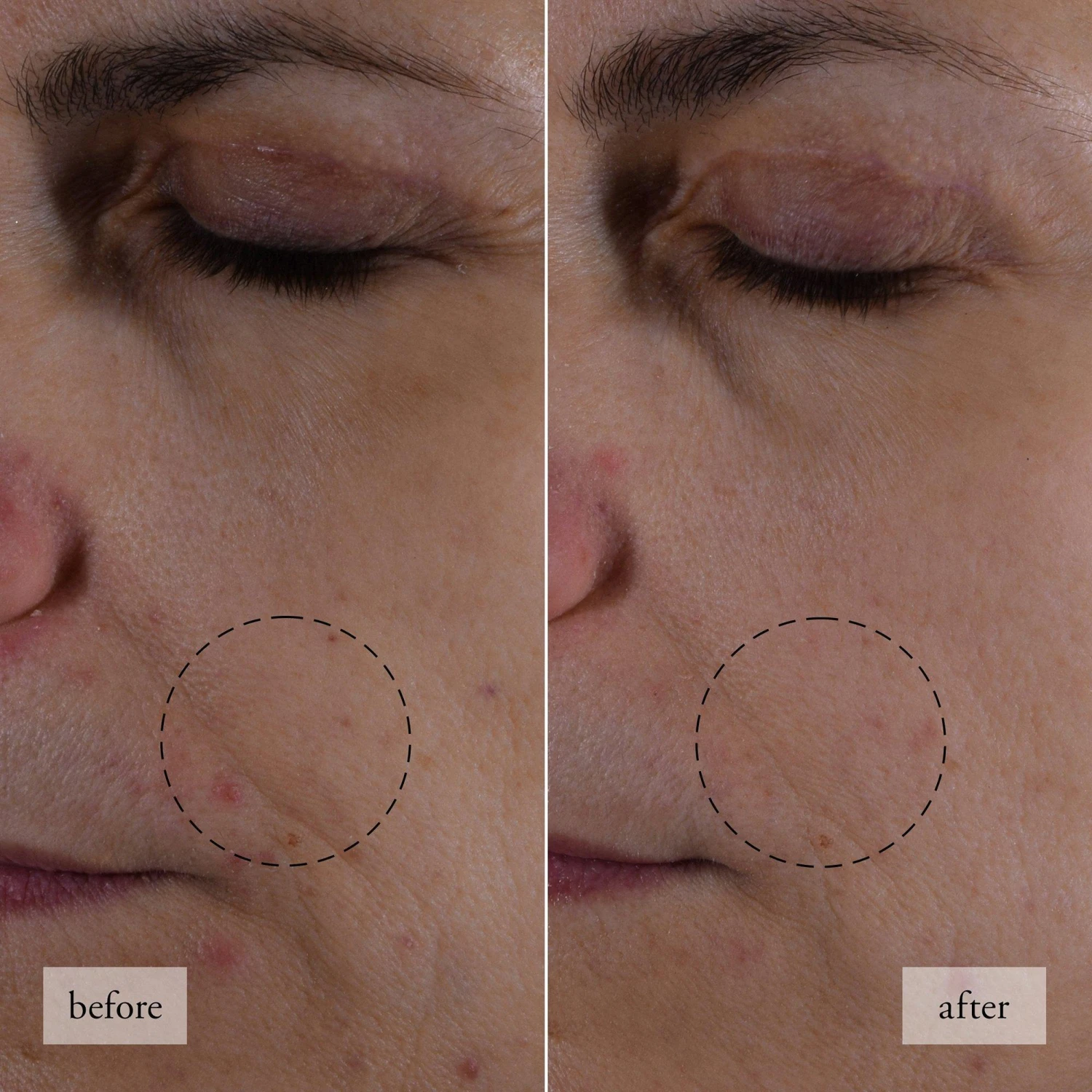 Philosophy Hope In A Jar Smooth-Glow Multi-Tasking Moisturizer 6 Philosophy Hope In A Jar Smooth-Glow Multi-Tasking Moisturizer - Image 6