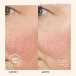 Power Cocktail Lactic Acid Repair Serum -Clinique || Lancome || L'Oreal Sales Shop 2589292 alt04