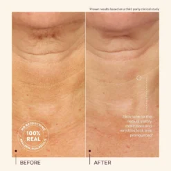 Power Cocktail Lactic Acid Repair Serum -Clinique || Lancome || L'Oreal Sales Shop 2589292 alt05