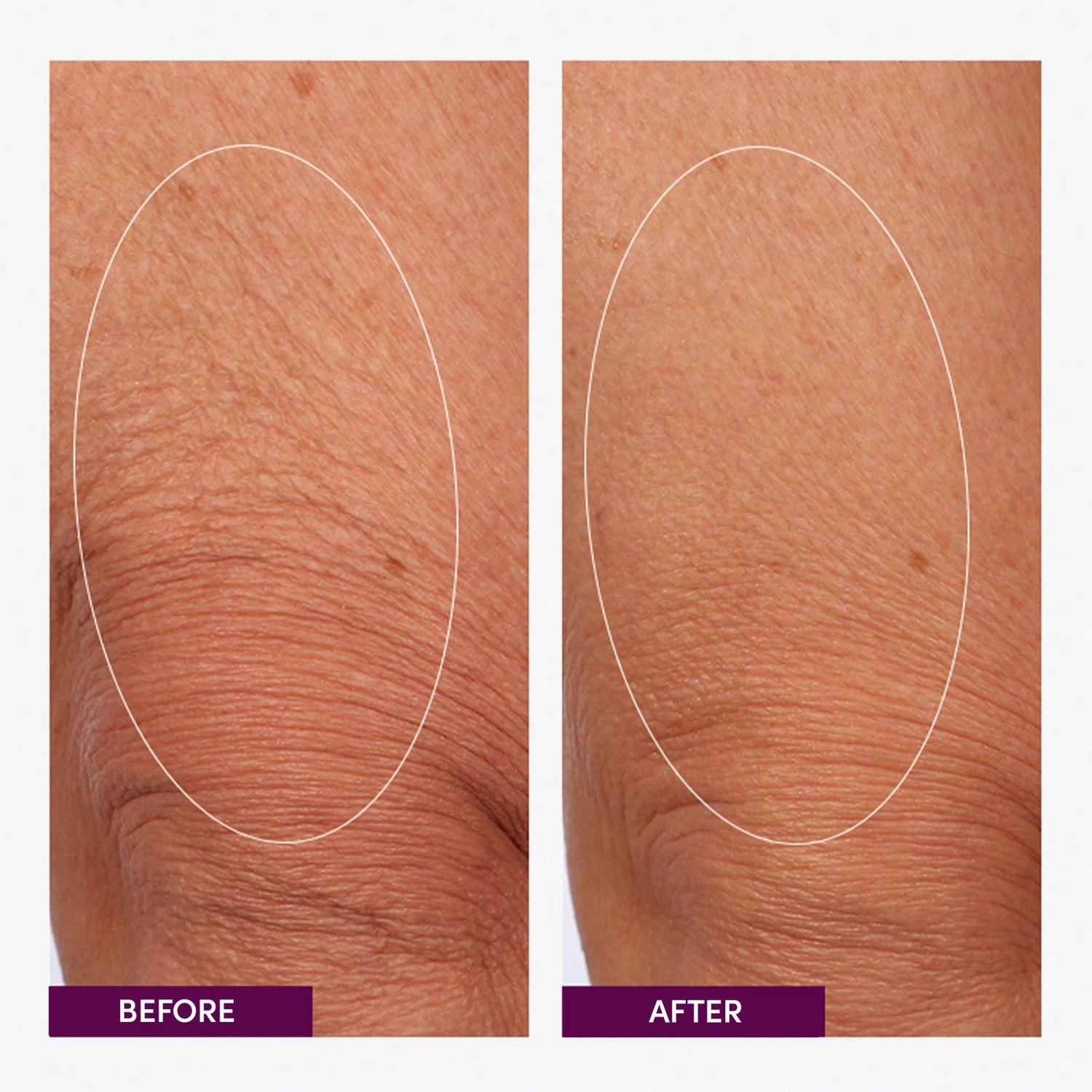 The Works Smoothing All-Over Body Cream 2 The Works Smoothing All-Over Body Cream - Image 2