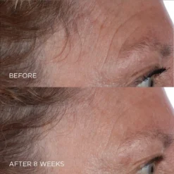 Perricone MD Cold Plasma Plus+ The Essence 7 Perricone MD Cold Plasma Plus+ The Essence -Clinique || Lancome || L'Oreal Sales Shop 2605142 alt05