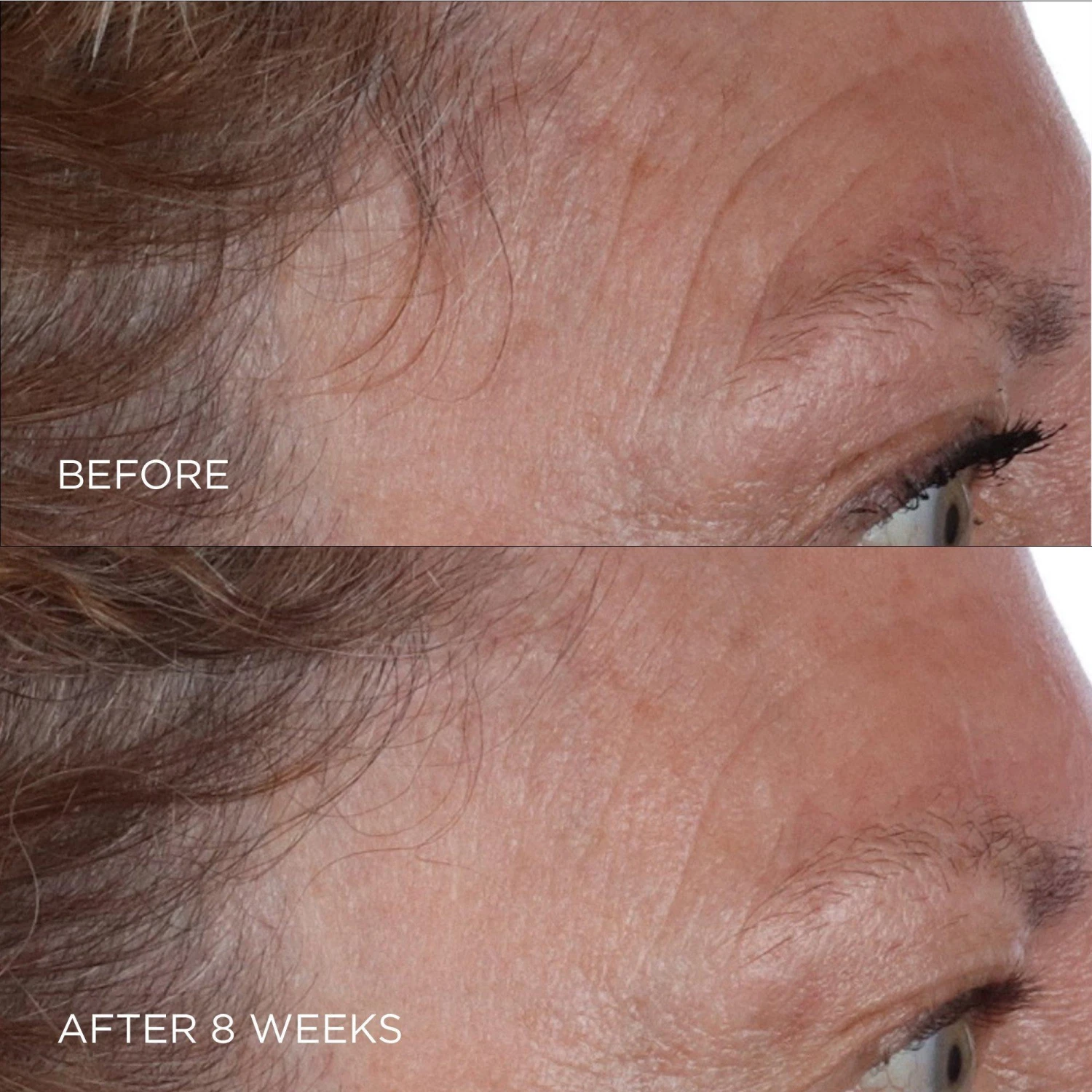 Perricone MD Cold Plasma Plus+ The Essence 3 Perricone MD Cold Plasma Plus+ The Essence - Image 3