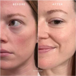 Chebula Extreme Cream -Clinique || Lancome || L'Oreal Sales Shop 2612694 alt02