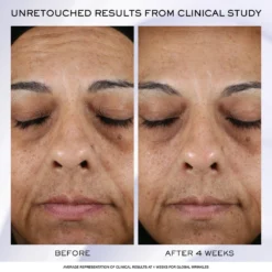 Lancome Rénergie H.P.N. 300-Peptide Cream 11 Lancome Rénergie H.P.N. 300-Peptide Cream -Clinique || Lancome || L'Oreal Sales Shop 2612984cm alt01
