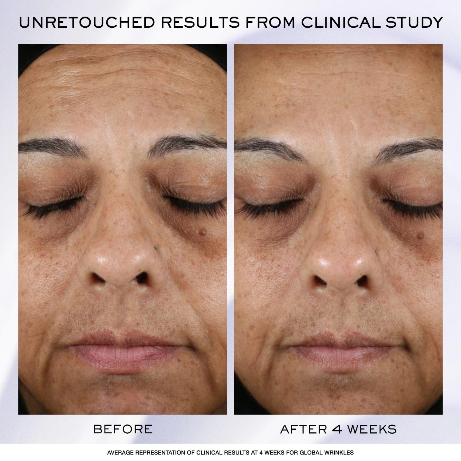 Lancome Rénergie H.P.N. 300-Peptide Cream 3 Lancome Rénergie H.P.N. 300-Peptide Cream - Image 3