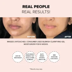 Nudestix Nudeskin Blemish Clarifying Gel Moisturizer 8 Nudestix Nudeskin Blemish Clarifying Gel Moisturizer -Clinique || Lancome || L'Oreal Sales Shop 2613624 alt02